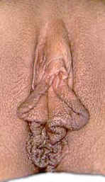 Moderately long labia minora.